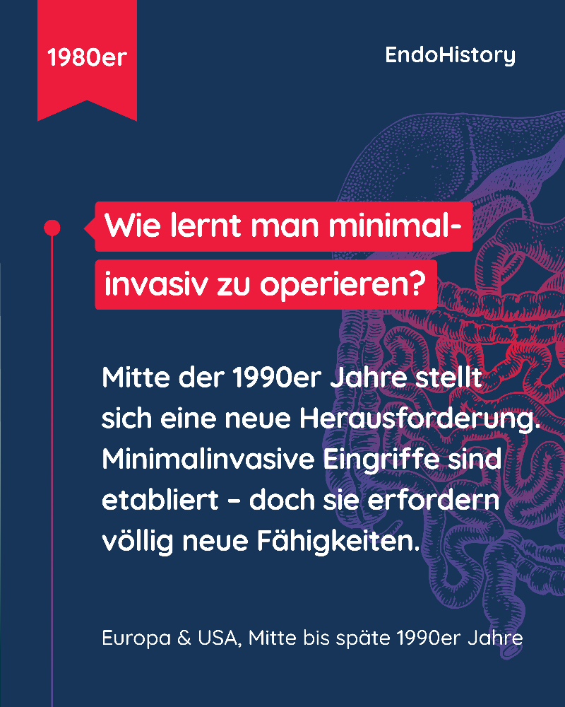EndoHistory: Wie lernt man minimal-invasiv zu operieren?