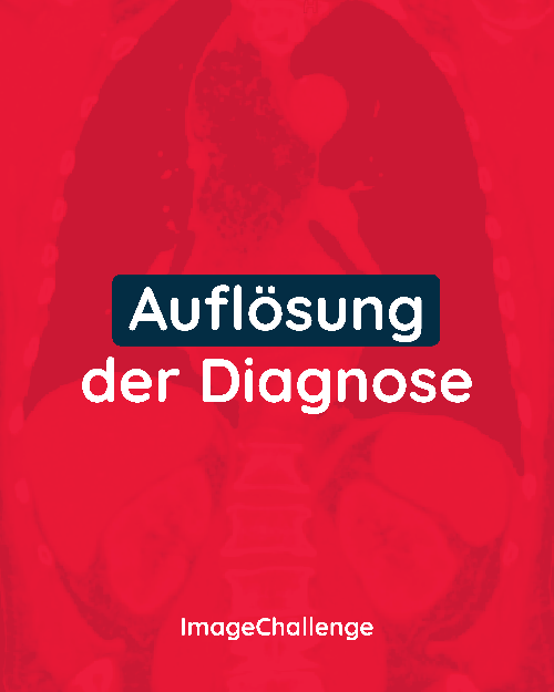 ImageChallenge: Auflösung der Diagnose