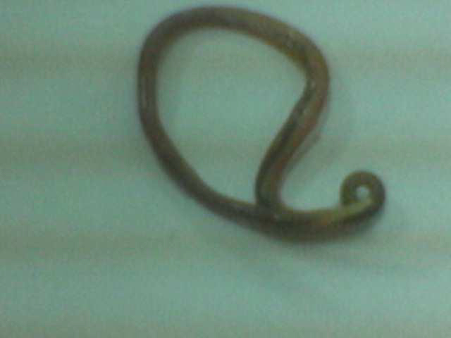 Ascaris Lumbricoides worm encountered in the stomach - Endoscopy