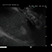 Sequenz 1 – Endosonographische Darstellung eines Gallenblasenempyems